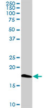 CETN1 MaxPab rabbit polyclonal antibody (D01)