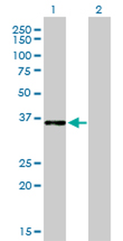 CEBPE monoclonal antibody (M01), clone 7A4