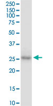 CDX1 monoclonal antibody (M01), clone 2D8