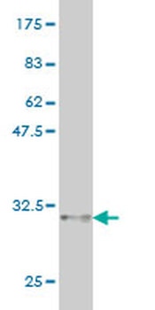 CDSN monoclonal antibody (M01), clone 6F11