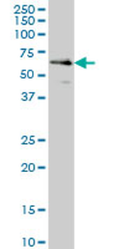 CDR2 monoclonal antibody (M01), clone 4F5