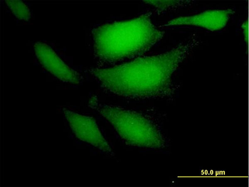 CDKN2C purified MaxPab mouse polyclonal antibody (B02P)