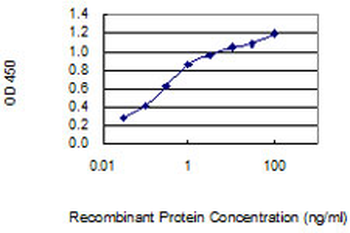 CDKN1B monoclonal antibody (M01), clone 4B4-E6