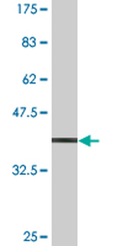 CDK9 monoclonal antibody (M07), clone 2D7