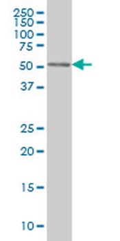 CDK8 monoclonal antibody (M04), clone 2E6