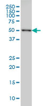 CDK8 monoclonal antibody (M03), clone 5H4