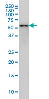 CDK8 monoclonal antibody (M02), clone 6E5