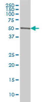 CDK8 monoclonal antibody (M01), clone 6H5
