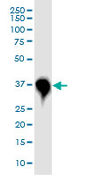CDK6 monoclonal antibody (M01J), clone 8H4