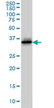 CDK6 monoclonal antibody (M01), clone 8H4