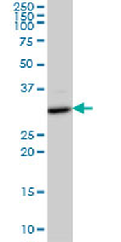 CDK4 monoclonal antibody (M07), clone 8C3