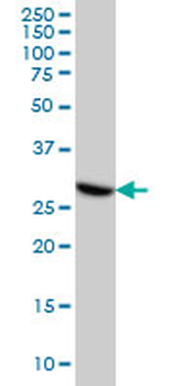 CDK4 monoclonal antibody (M04), clone 2G7