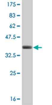 CDK4 monoclonal antibody (M03), clone 4F11