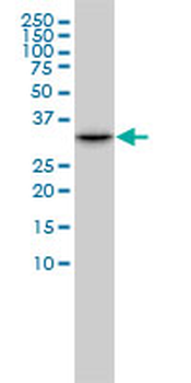 CDK2 monoclonal antibody (M02), clone 2E8