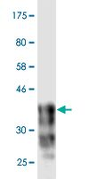 CDH18 monoclonal antibody (M02), clone 4H2