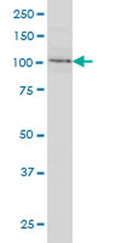 CDH18 monoclonal antibody (M01), clone 6F7