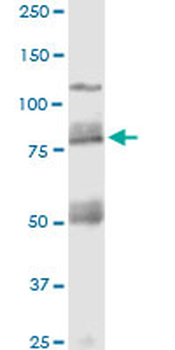 CDH11 monoclonal antibody (M05), clone 3C8