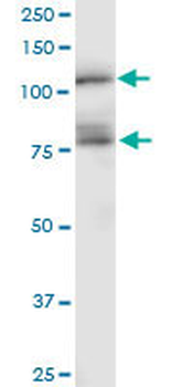 CDH11 monoclonal antibody (M04), clone 1A5