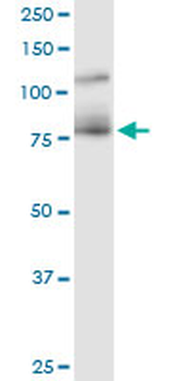 CDH11 monoclonal antibody (M02), clone 1H1