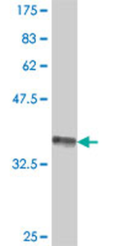 CDH8 polyclonal antibody (A01)