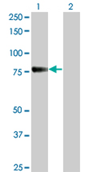 CDH6 monoclonal antibody (M05), clone 2F2