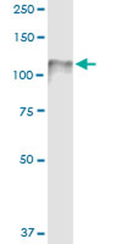 CDH3 MaxPab rabbit polyclonal antibody (D01)