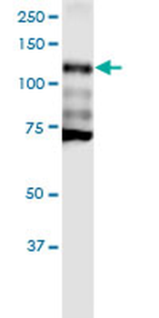 CDH1 monoclonal antibody (M01), clone 3F4
