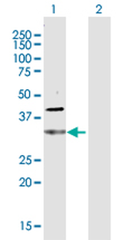 CDC34 purified MaxPab rabbit polyclonal antibody (D01P)