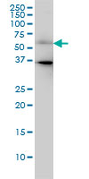 CDC25C monoclonal antibody (M01), clone 3B11
