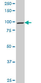 CDC5L polyclonal antibody (A01)