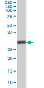 CDC2 monoclonal antibody (M04), clone 8F1