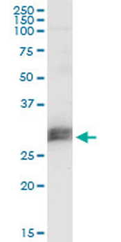 CD151 monoclonal antibody (M02), clone 1B2