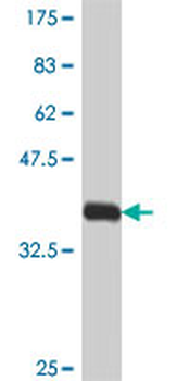 CD97 polyclonal antibody (A01)