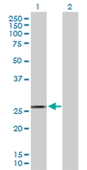 CD79A purified MaxPab rabbit polyclonal antibody (D01P)