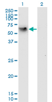 CD44 monoclonal antibody (M05), clone 2H5