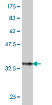 ENTPD5 polyclonal antibody (A01)