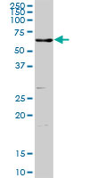 ENTPD3 purified MaxPab rabbit polyclonal antibody (D01P)