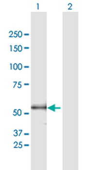 ENTPD3 purified MaxPab mouse polyclonal antibody (B01P)