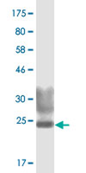 TNFSF8 monoclonal antibody (M07), clone 4A6