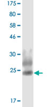 TNFSF8 monoclonal antibody (M06), clone 4A10