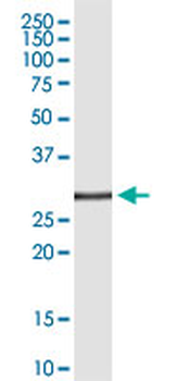 TNFSF8 monoclonal antibody (M02), clone 1E1