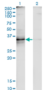 TNFSF8 monoclonal antibody (M01A), clone 2E11