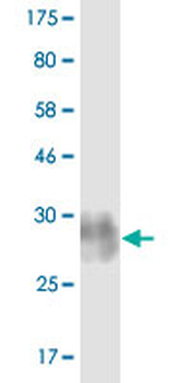 CD86 monoclonal antibody (M12), clone 5F10