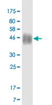 CD86 monoclonal antibody (M11), clone 3F2
