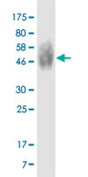 CD86 monoclonal antibody (M09), clone 3A6