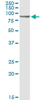CD19 monoclonal antibody (M01), clone 1G3