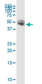 CD14 MaxPab rabbit polyclonal antibody (D01)