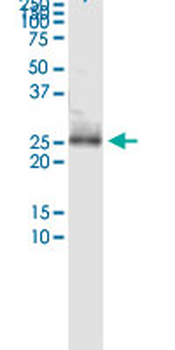 CD8B MaxPab rabbit polyclonal antibody (D01)