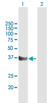 CD5L purified MaxPab mouse polyclonal antibody (B01P)