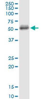 CD5 monoclonal antibody (M01), clone 2F7
